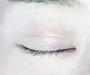 VDフォトプラスの後