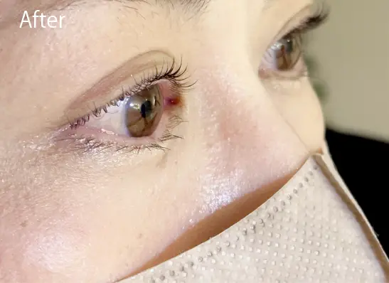 BeforeAfter画像02AIリフトパーマ