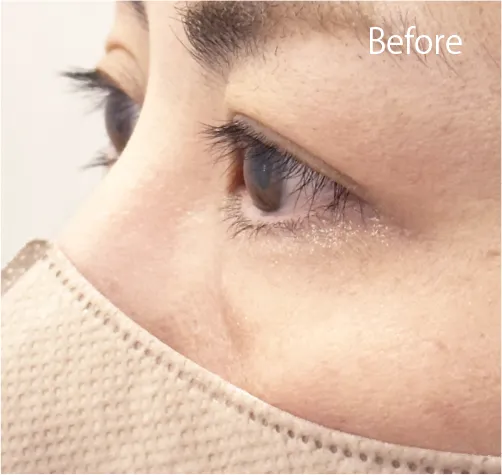 BeforeAfter画像02AIリフトパーマ