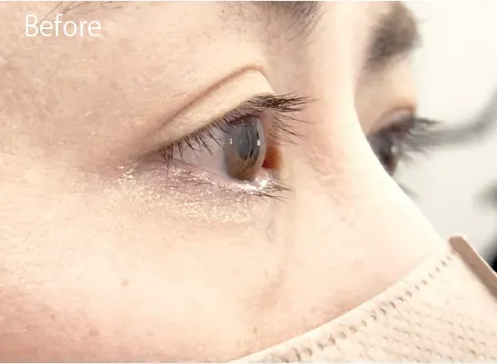 BeforeAfter画像02AIリフトパーマ