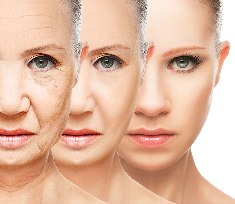 HGFジェットリバースの効果