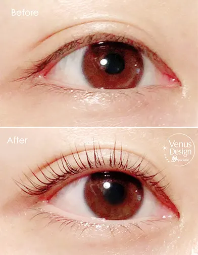 ヴィーナスデザイン上下まつ毛パーマBeforeAfterの画像