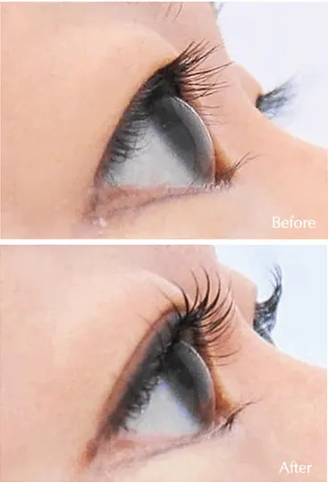 ヴィーナスデザイン上下まつ毛パーマBeforeAfterの画像
