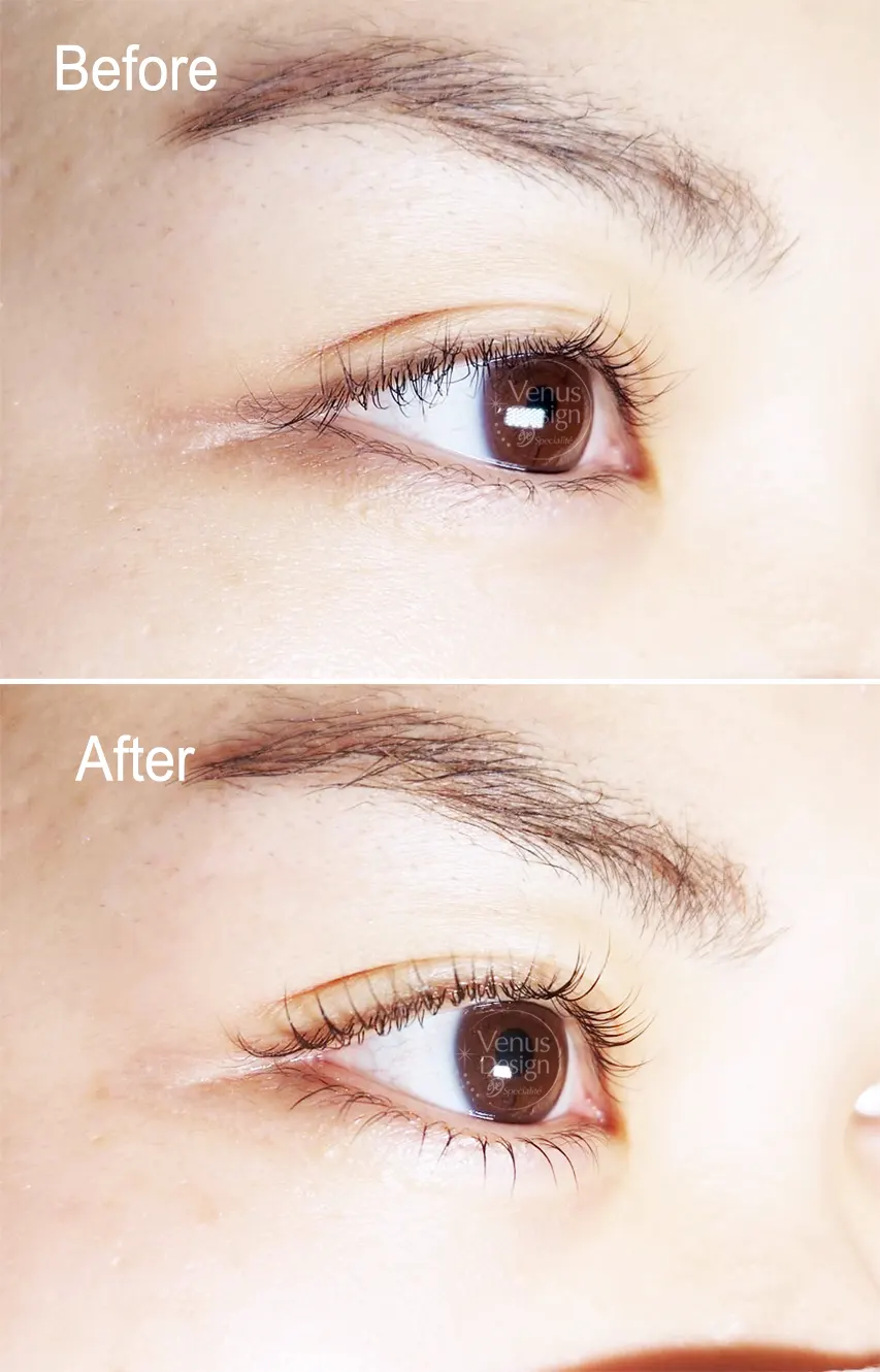 ヴィーナスデザイン上下まつ毛パーマBeforeAfterの画像