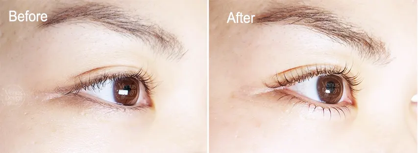 まつ毛パーマBeforeAfterの画像
