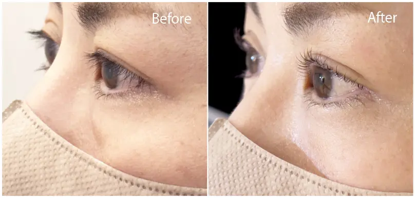 AIリフトパーマ-BeforeAfter画像