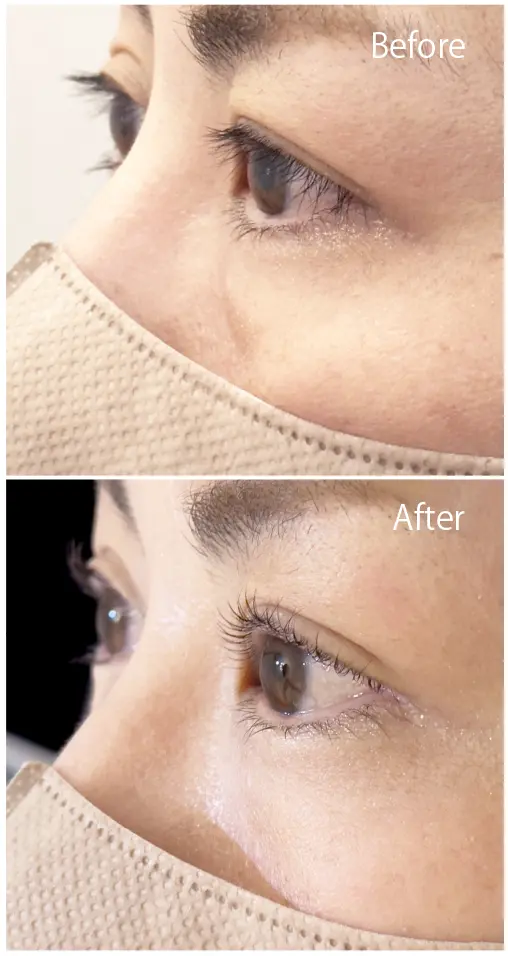 AIリフトパーマ-BeforeAfter画像