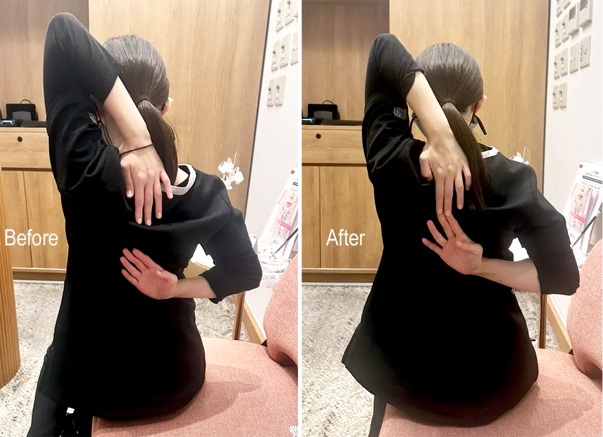 スタッフが本気で体感！首肩エクソソームショット BeforeAfter ＆ 感想