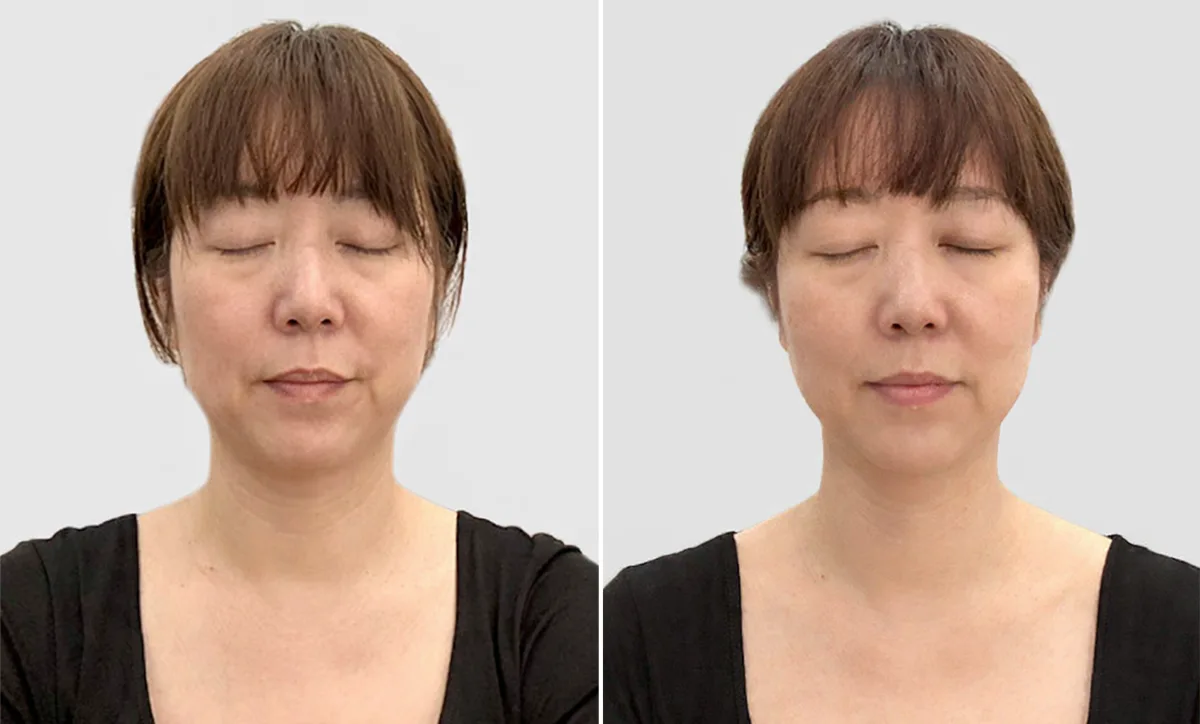 頭皮を整えることで、起きてくること BeforeAfter