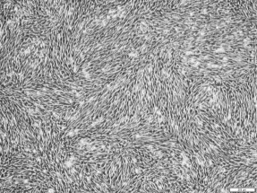 C社培地（使用エクソソーム）