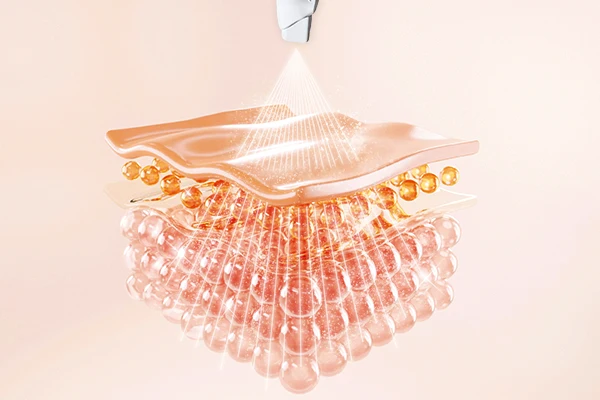 エクソソーム導入のイメージ