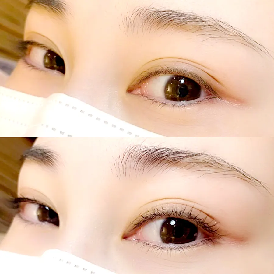 まつ毛カールのない状態のBEFOREからAFTER片目30本づつ（両目60本）のアイスペシャリテ®ミラクルエクステンション